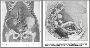 Medici, Elena Scaggiante, Canadausa