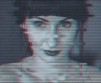 Demenza giovanile: i servizi alla persona